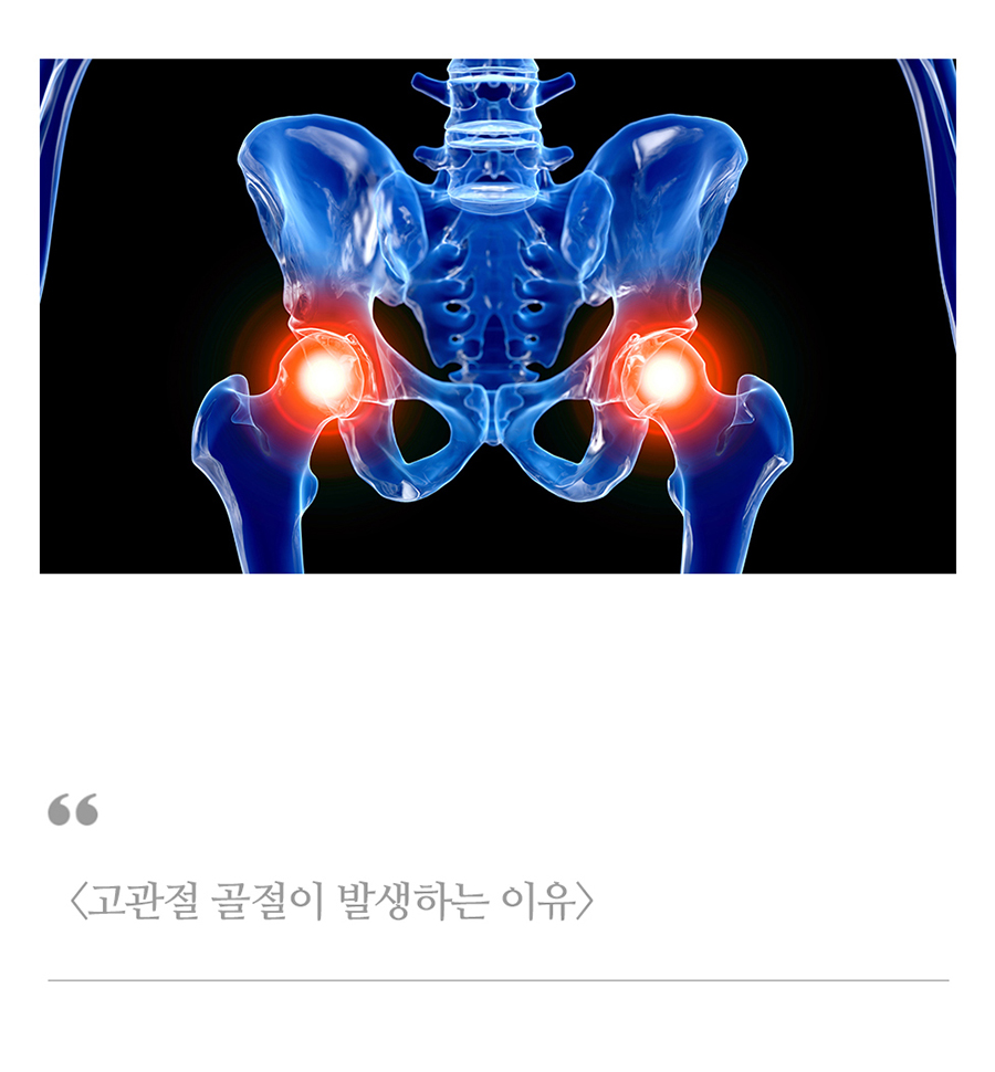 수원시골절정형외과 골절은 초기 치료가 회복 속도를 좌우합니다 05