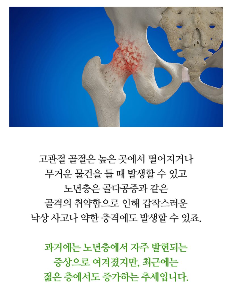 수원시골절정형외과 골절은 초기 치료가 회복 속도를 좌우합니다 06